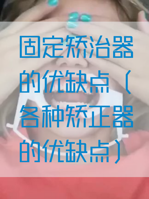 固定矫治器的优缺点（各种矫正器的优缺点）