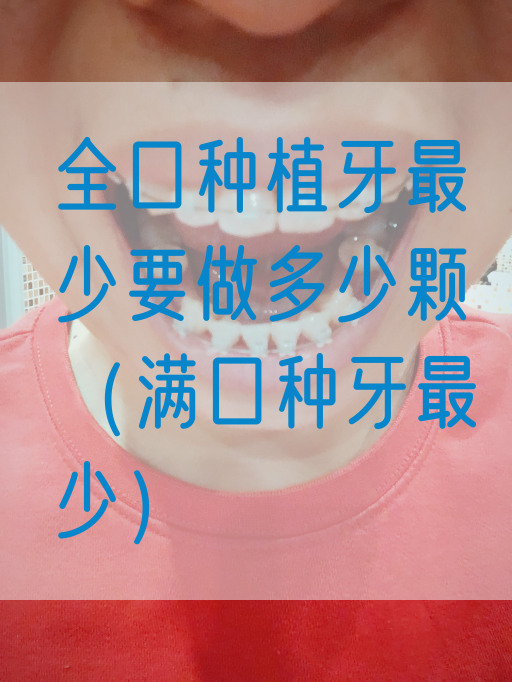 全口种植牙最少要做多少颗（满口种牙最少）