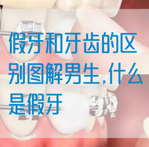 假牙和牙齿的区别图解男生,什么是假牙