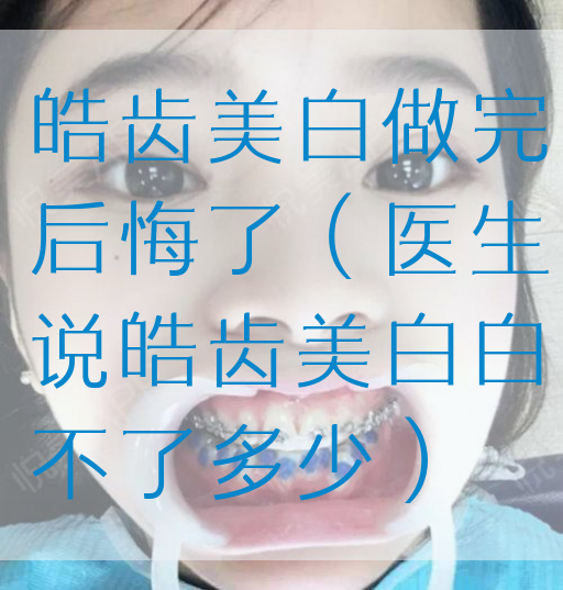 皓齿美白做完后悔了（医生说皓齿美白白不了多少）