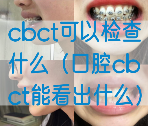 cbct可以检查什么（口腔cbct能看出什么）