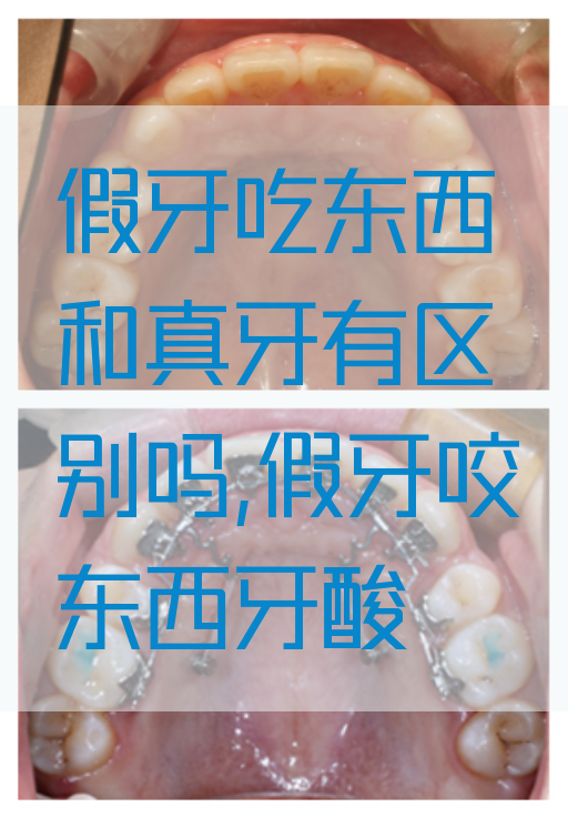 假牙吃东西和真牙有区别吗,假牙咬东西牙酸