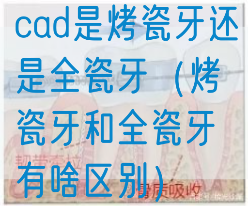cad是烤瓷牙还是全瓷牙（烤瓷牙和全瓷牙有啥区别）