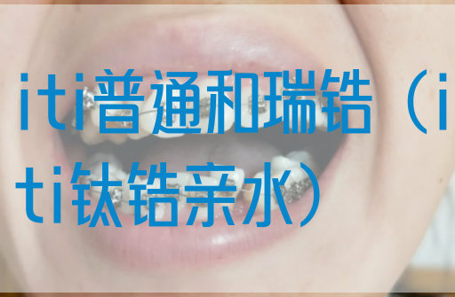 iti普通和瑞锆（iti钛锆亲水）
