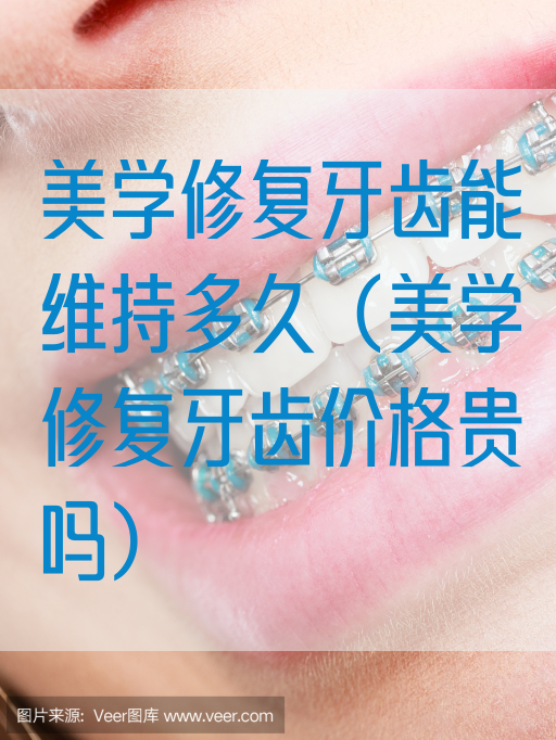 美学修复牙齿能维持多久（美学修复牙齿价格贵吗）