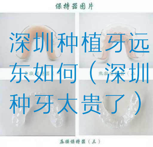 深圳种植牙远东如何（深圳种牙太贵了）