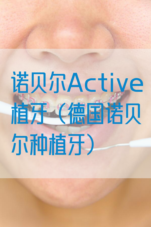 诺贝尔Active植牙（德国诺贝尔种植牙）