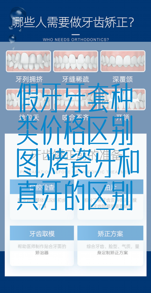 假牙牙套种类价格区别图,烤瓷牙和真牙的区别