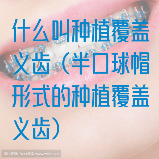 什么叫种植覆盖义齿（半口球帽形式的种植覆盖义齿）