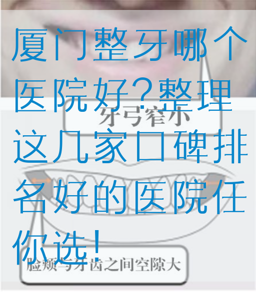 厦门整牙哪个医院好?整理这几家口碑排名好的医院任你选!