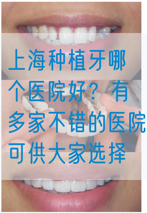 上海种植牙哪个医院好？有多家不错的医院可供大家选择