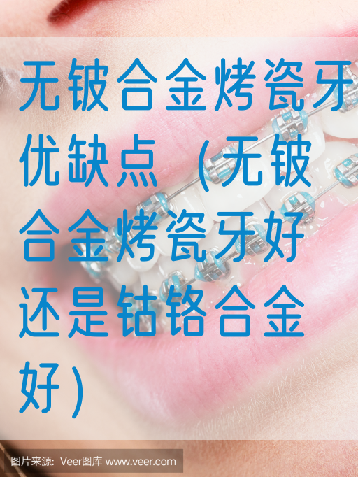 无铍合金烤瓷牙优缺点（无铍合金烤瓷牙好还是钴铬合金好）