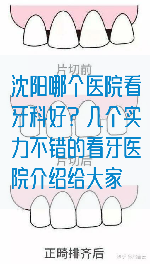 沈阳哪个医院看牙科好？几个实力不错的看牙医院介绍给大家