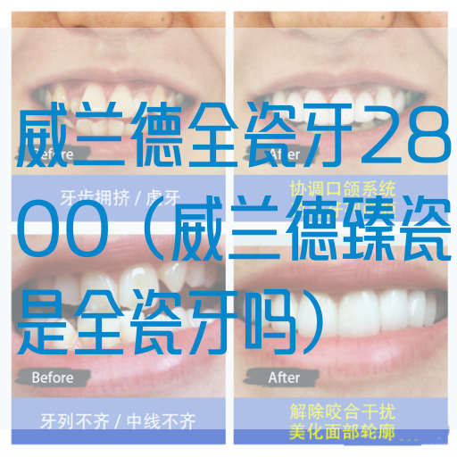 威兰德全瓷牙2800（威兰德臻瓷是全瓷牙吗）