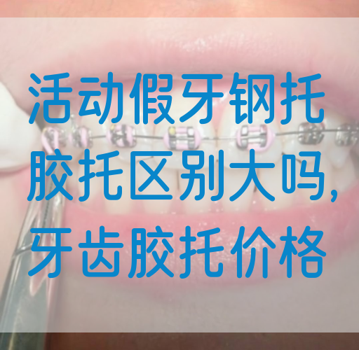 活动假牙钢托胶托区别大吗,牙齿胶托价格