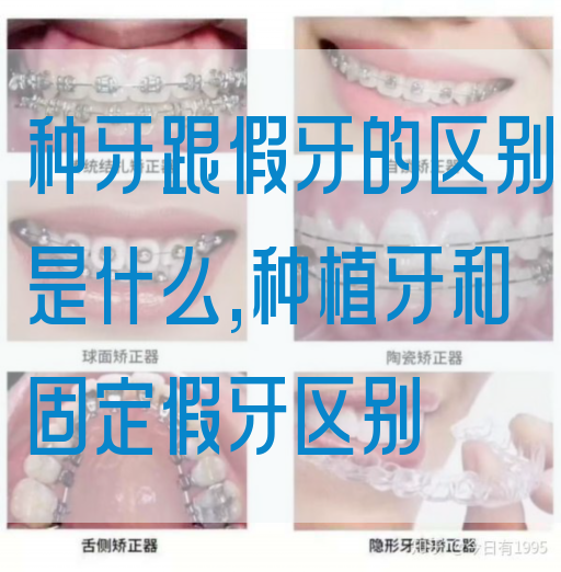 种牙跟假牙的区别是什么,种植牙和固定假牙区别