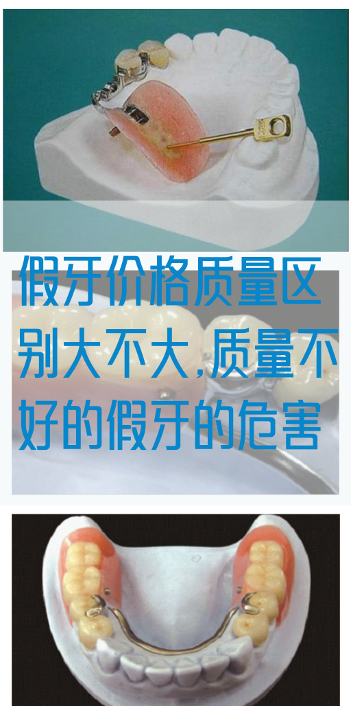 假牙价格质量区别大不大,质量不好的假牙的危害