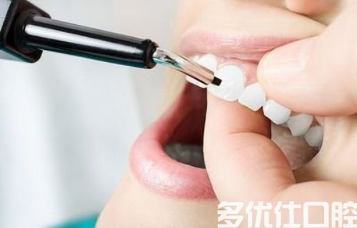 武汉哪个医院有隐形牙套？上榜的都是公li医院(图2)