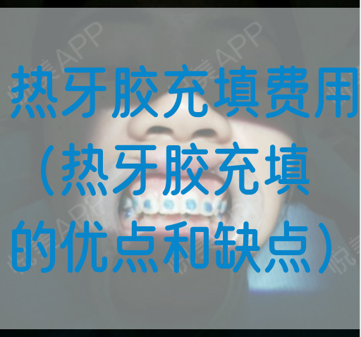 热牙胶充填费用（热牙胶充填的优点和缺点）