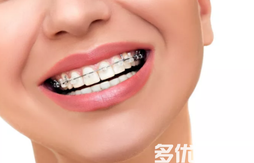 去南京哪个医院装牙齿好？附镶牙+单颗牙种植+补牙参考价格(图1)