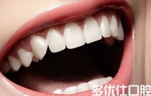 去南京哪个医院装牙齿好？附镶牙+单颗牙种植+补牙参考价格(图2)