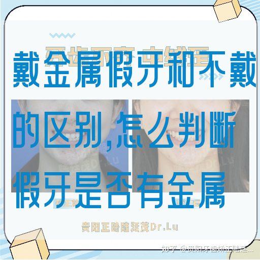 戴金属假牙和不戴的区别,怎么判断假牙是否有金属