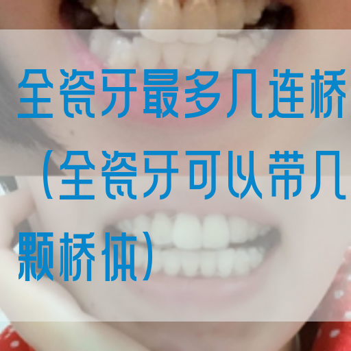 全瓷牙最多几连桥（全瓷牙可以带几颗桥体）