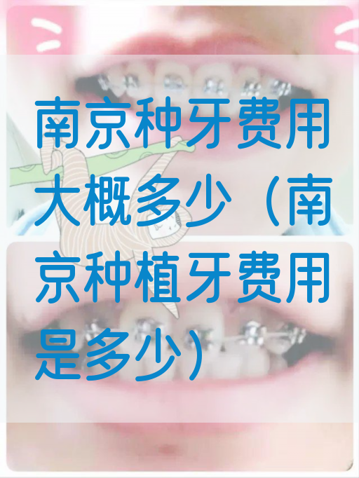 南京种牙费用大概多少（南京种植牙费用是多少）