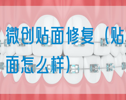 微创贴面修复（贴面怎么样）