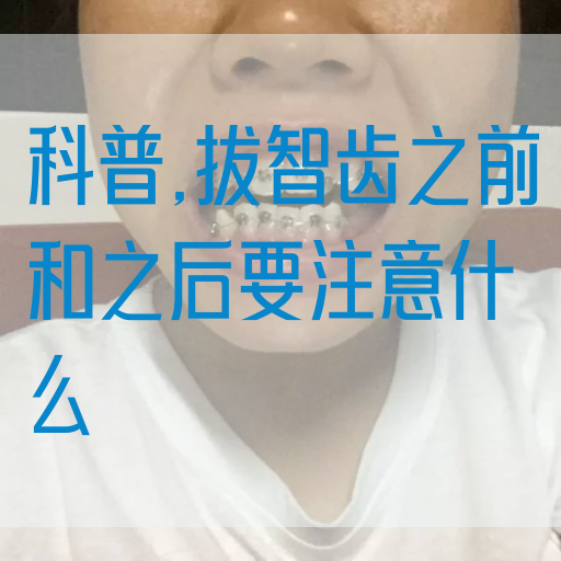 科普,拔智齿之前和之后要注意什么