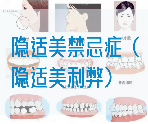 隐适美禁忌症（隐适美利弊）