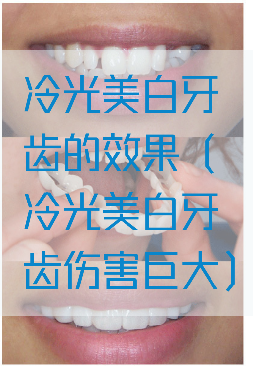 冷光美白牙齿的效果（冷光美白牙齿伤害巨大）