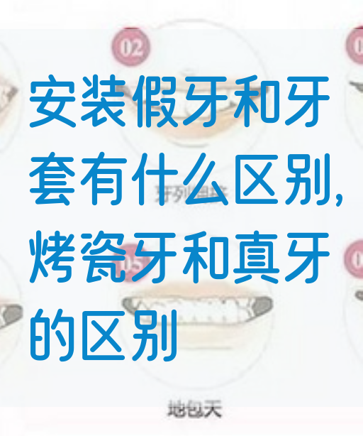 安装假牙和牙套有什么区别,烤瓷牙和真牙的区别