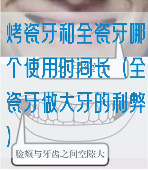 烤瓷牙和全瓷牙哪个使用时间长（全瓷牙做大牙的利弊）