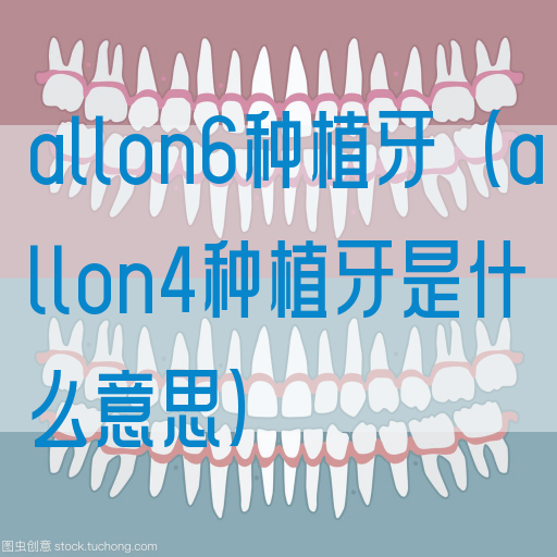 allon6种植牙（allon4种植牙是什么意思）