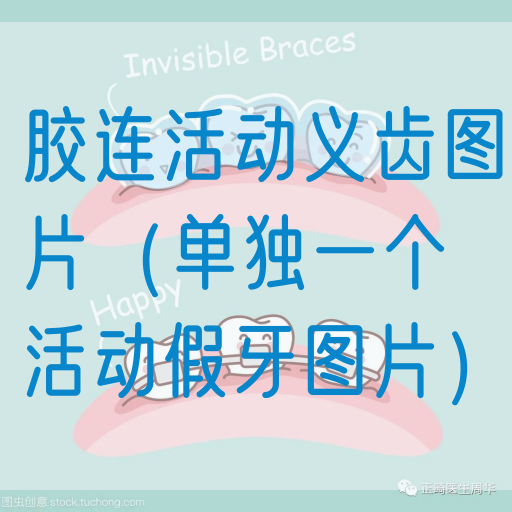胶连活动义齿图片（单独一个活动假牙图片）