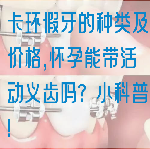 卡环假牙的种类及价格,怀孕能带活动义齿吗？小科普！