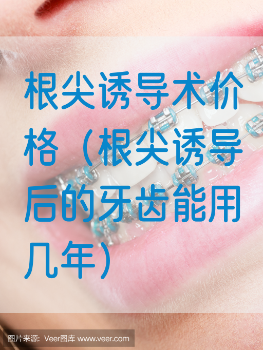 根尖诱导术价格（根尖诱导后的牙齿能用几年）