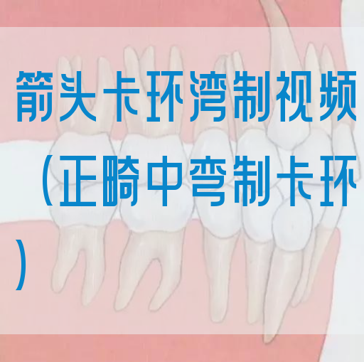 箭*卡环湾制视频（正畸中弯制卡环）