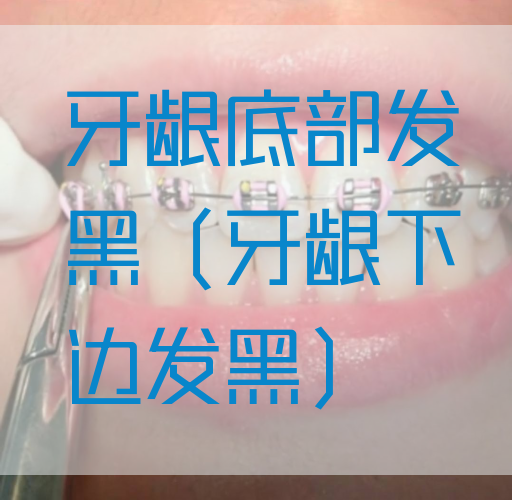 牙龈底部发黑（牙龈下边发黑）