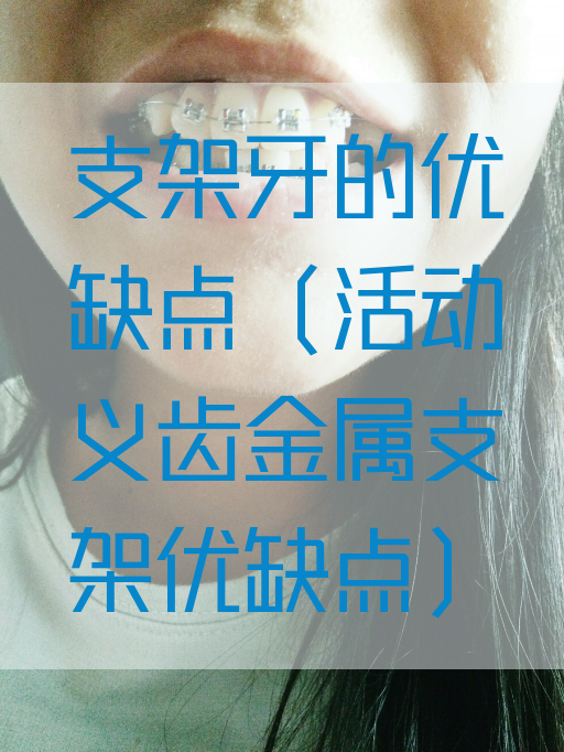 支架牙的优缺点（活动义齿金属支架优缺点）