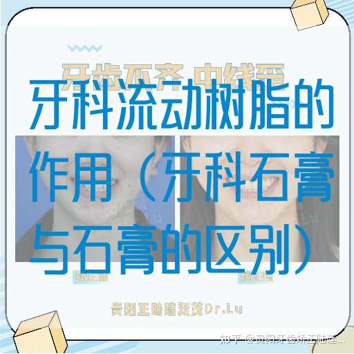 牙科流动树脂的作用（牙科石膏与石膏的区别）