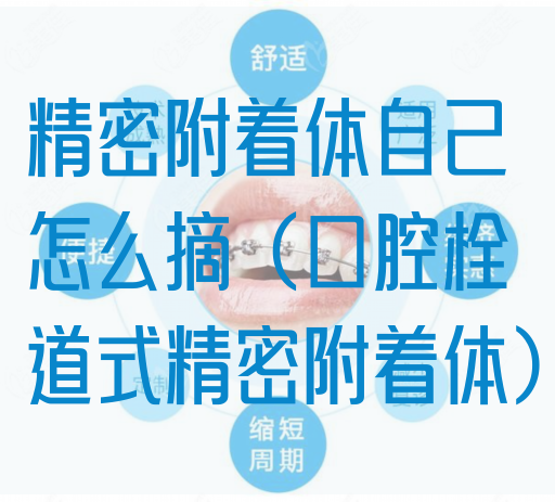 *密附着体自己怎么摘（口腔栓道式*密附着体）