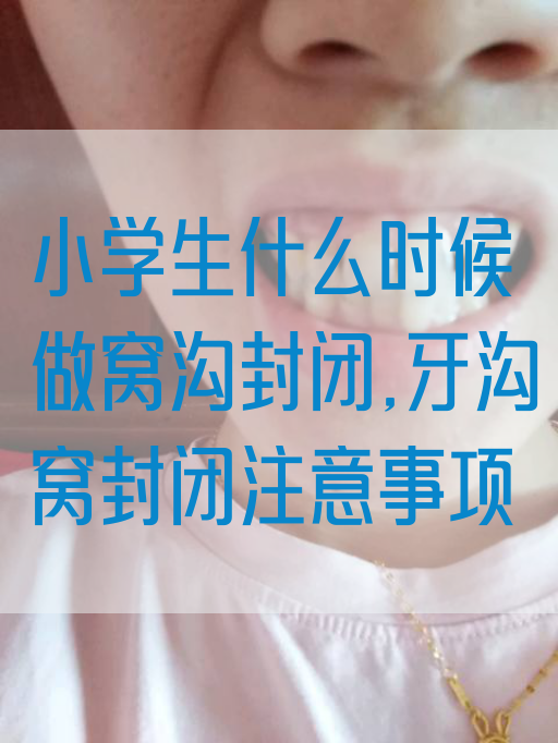 小学生什么时候做窝沟封闭,牙沟窝封闭注意事项