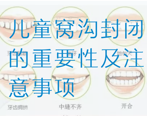 儿童窝沟封闭的重要性及注意事项