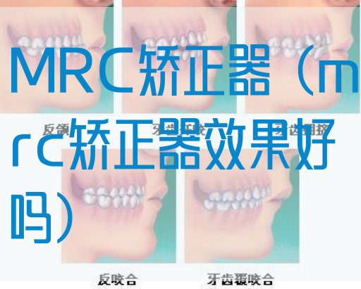MRC矫正器（mrc矫正器效果好吗）