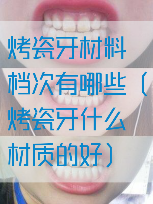 烤瓷牙材料档次有哪些（烤瓷牙什么材质的好）