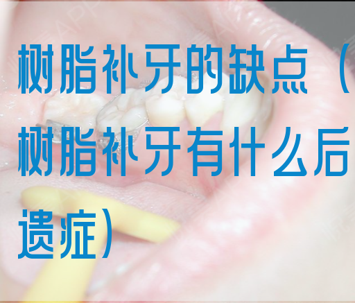 树脂补牙的缺点（树脂补牙有什么后遗症）
