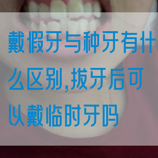 戴假牙与种牙有什么区别,拔牙后可以戴临时牙吗