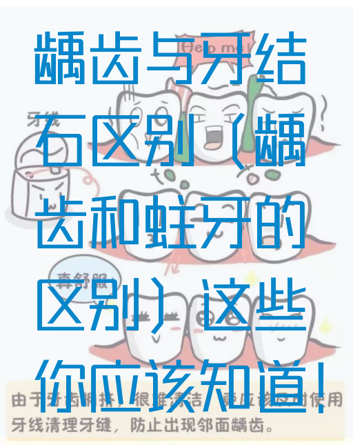 龋齿与牙结石区别（龋齿和蛀牙的区别）这些你应该知道！